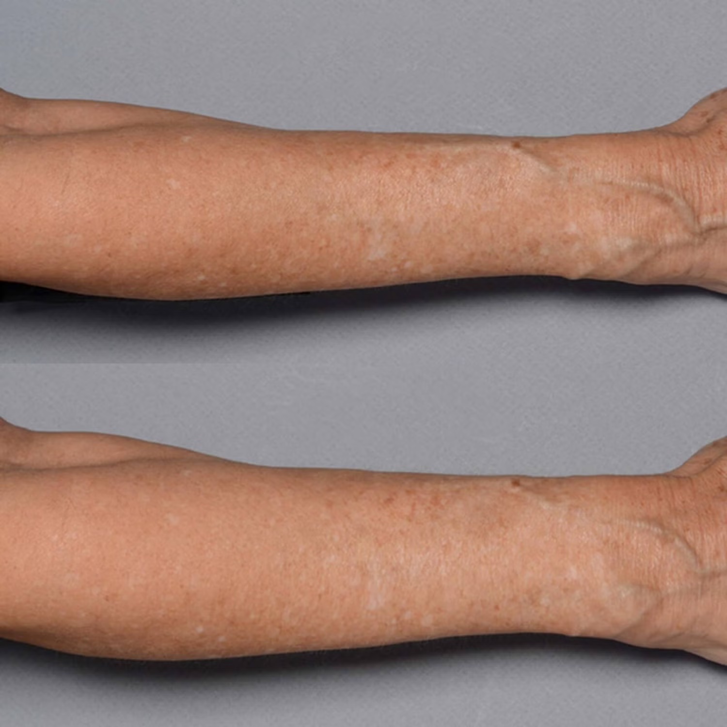 PERRICONE MD Cold Plasma Plus+ Fragile Skin Therapy купить в Beauty Storage. Быстрая доставка по России и СНГ.