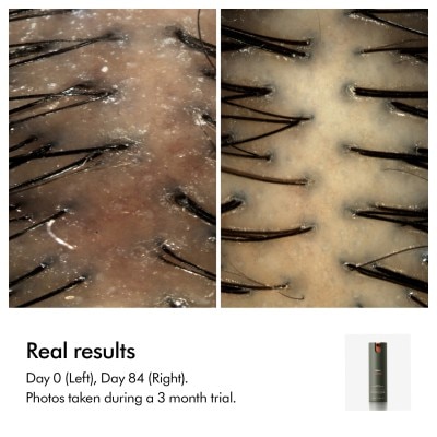 Купить DYSON Amino™ Leave-In Scalp Bubble Treatment на Beautystorage.ru. Быстрая доставка по России и СНГ.
