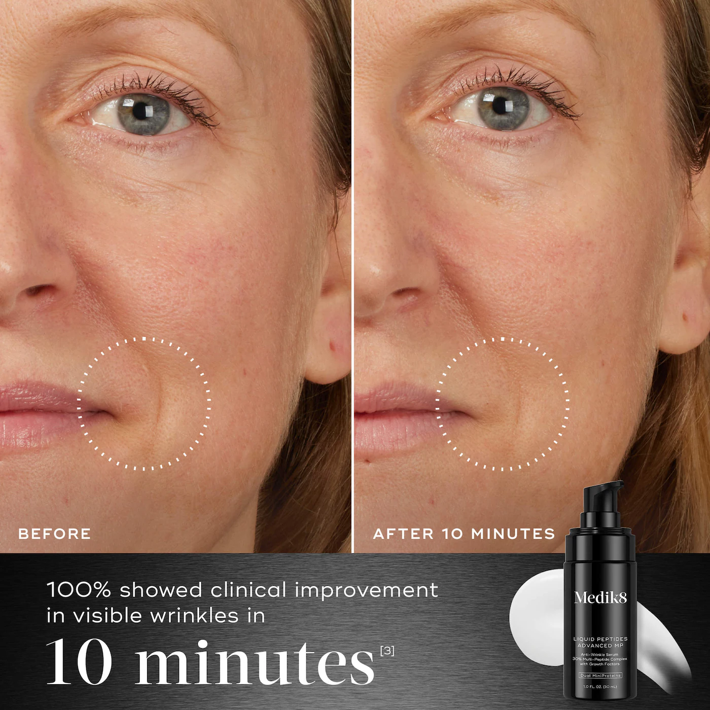 Купить MEDIK8 Liquid Peptides Advanced MP на Beautystorage.ru. Быстрая доставка по России и СНГ.