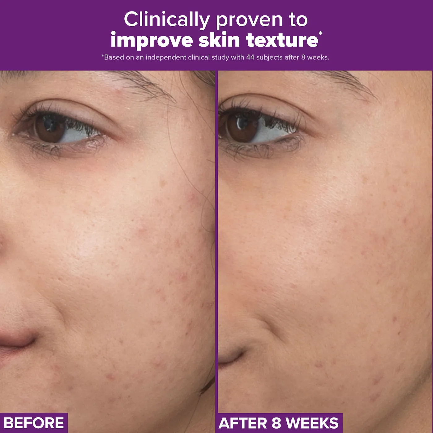 PAULA'S CHOICE Clinical PRO Retinaldehyde Dual-Retinoid Treatment купить в Beauty Storage. Быстрая доставка по России и СНГ.