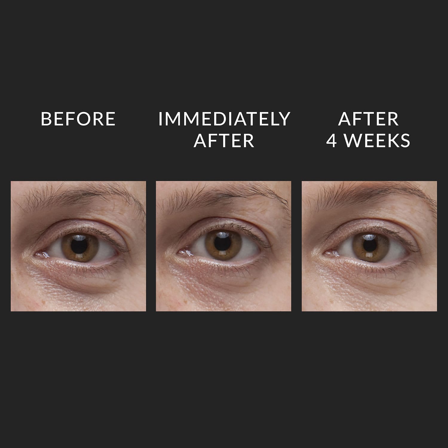 KATE SOMERVILLE DermalQuench® Hyaluronic Acid Hydration Treatment купить в Beauty Storage. Быстрая доставка по России и СНГ.