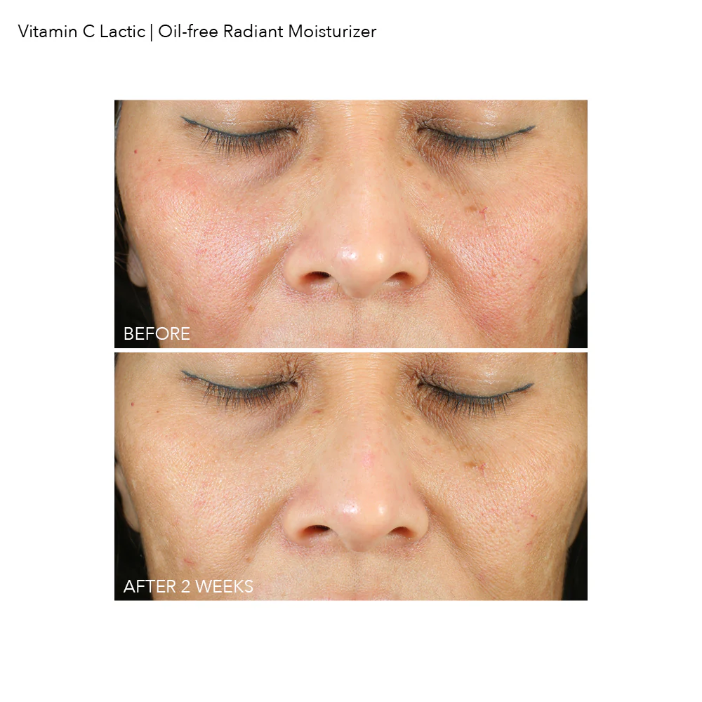 DR. DENNIS GROSS Vitamin C Lactic Oil-Free Radiant Moisturizer купить в Beauty Storage. Быстрая доставка по России и СНГ.