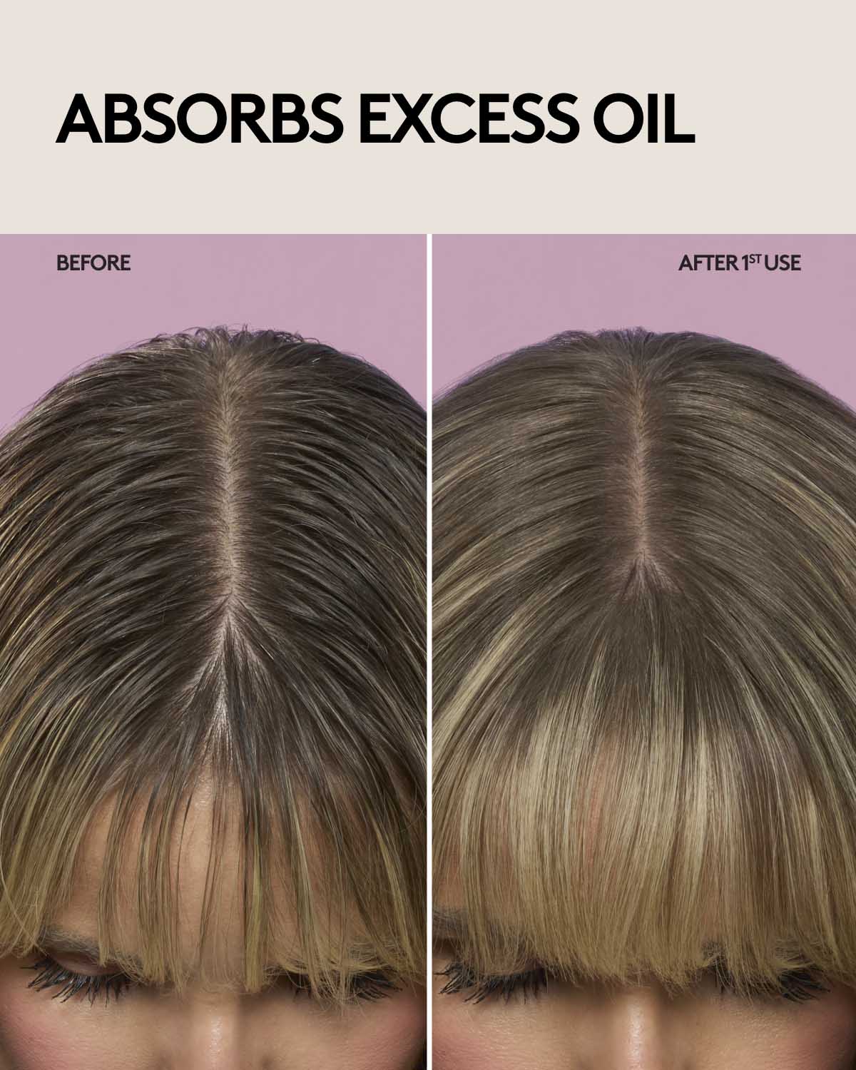 Купить FENTY HAIR The Imposter Invisi-Boost Volumizing Dry Shampoo на Beautystorage.ru. Быстрая доставка по России и СНГ.