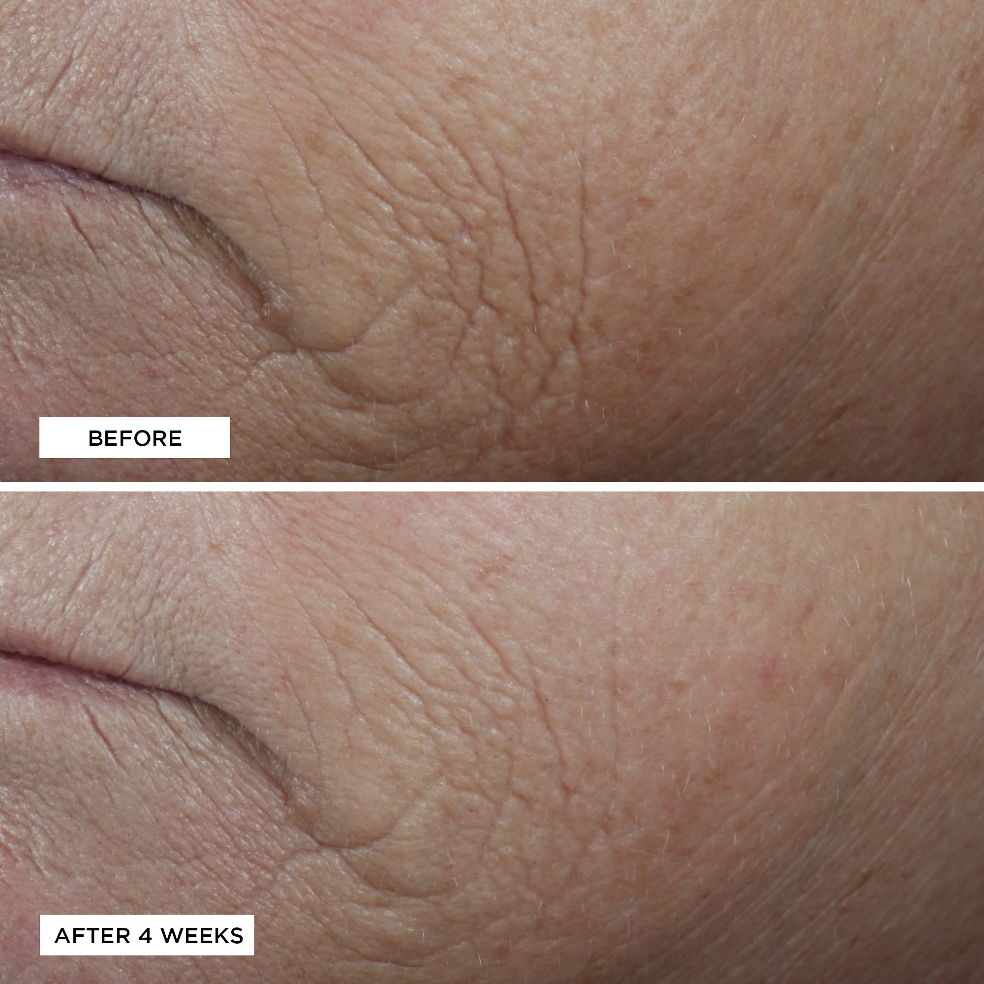 PERRICONE MD Neuropeptide Smoothing Facial Conformer