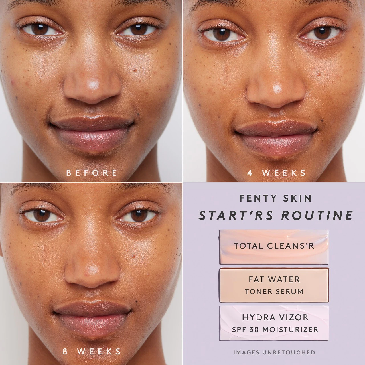 FENTY SKIN by Rihanna  Total Cleans'r Remove-It-All Cleanser купить в Beauty Storage. Быстрая доставка по России и СНГ.