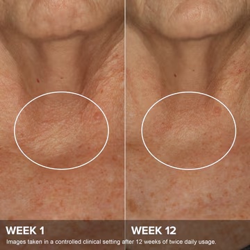 PAULA'S CHOICE CLINICAL Phytoestrogen Elasticity Renewal Body Treatment купить в Beauty Storage. Быстрая доставка по России и СНГ.
