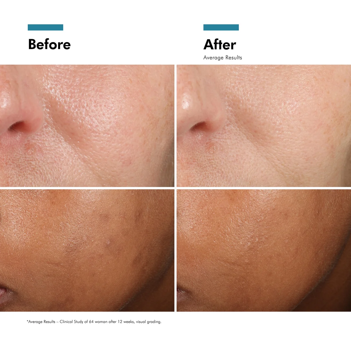 Купить SKINCEUTICALS Discoloration Defense Corrective Serum на Beautystorage.ru. Быстрая доставка по России и СНГ.