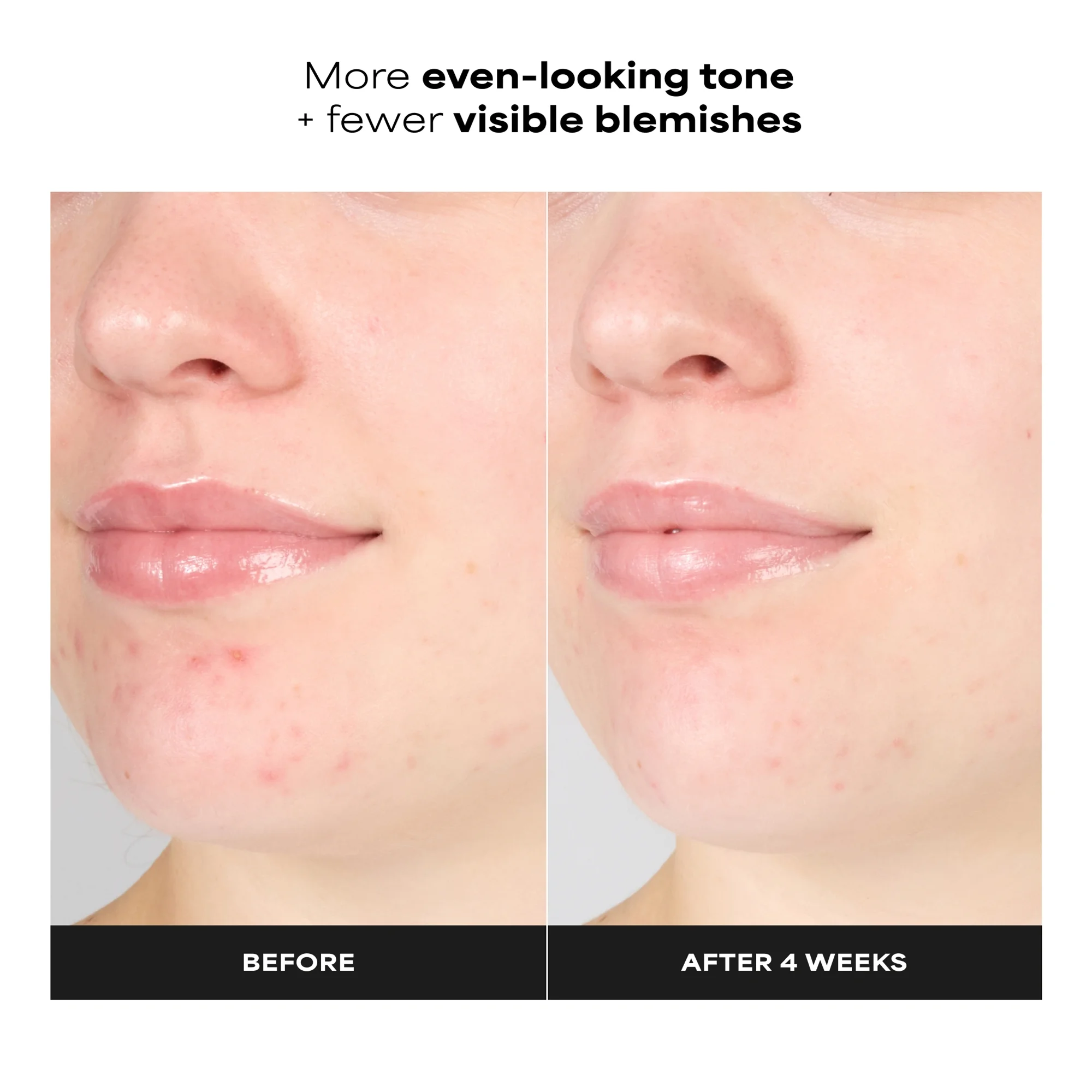Купить PAULA'S CHOICE Skin Perfecting 1% BHA Gentle Exfoliating Gel Toner на Beautystorage.ru. Быстрая доставка по России и СНГ.
