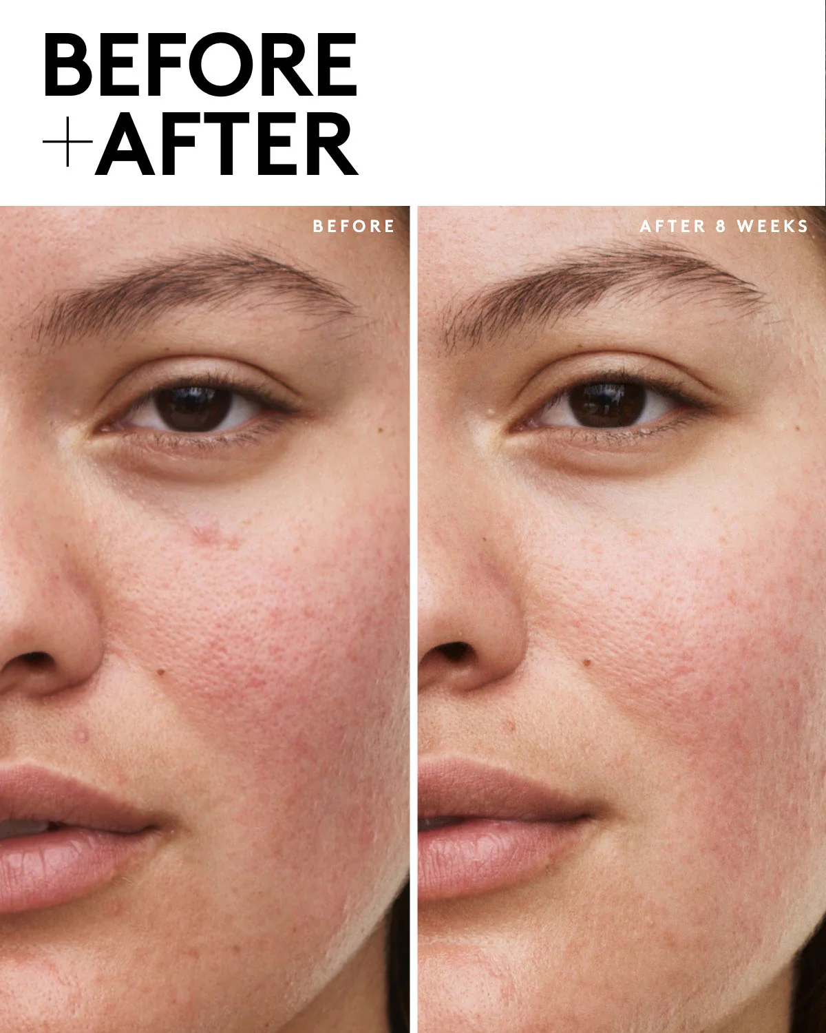 FENTY SKIN Travel-Size Start'r Set With Mineral Spf: Dry Skin Edition