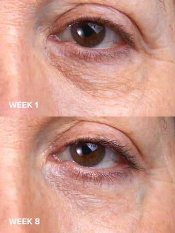 PAULA'S CHOICE C5 Super Boost Eye Cream купить в Beauty Storage. Быстрая доставка по России и СНГ.
