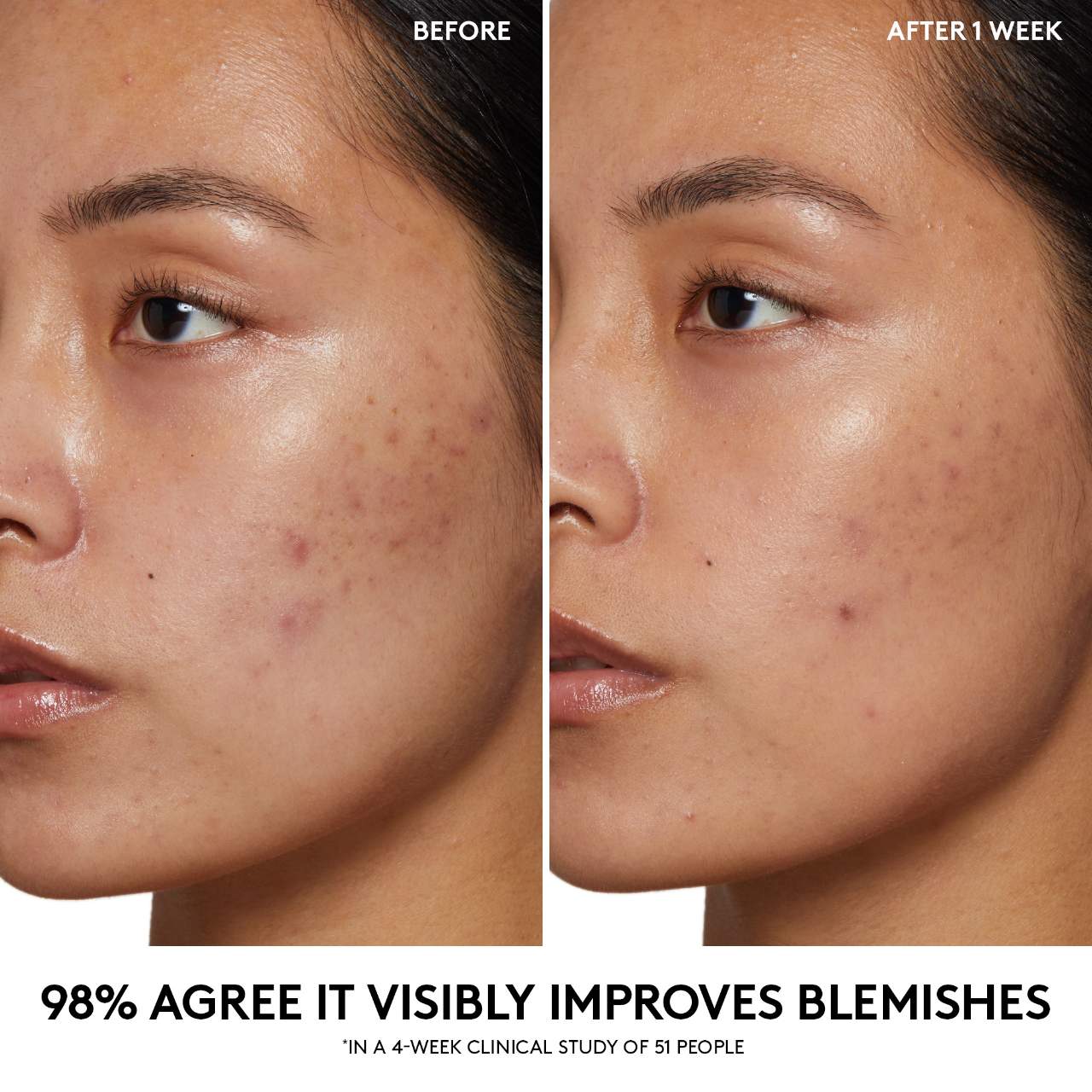 FENTY BEAUTY by Rihanna  Cherry Dub Pore Purify’r Gel Cleanser купить в Beauty Storage. Быстрая доставка по России и СНГ.