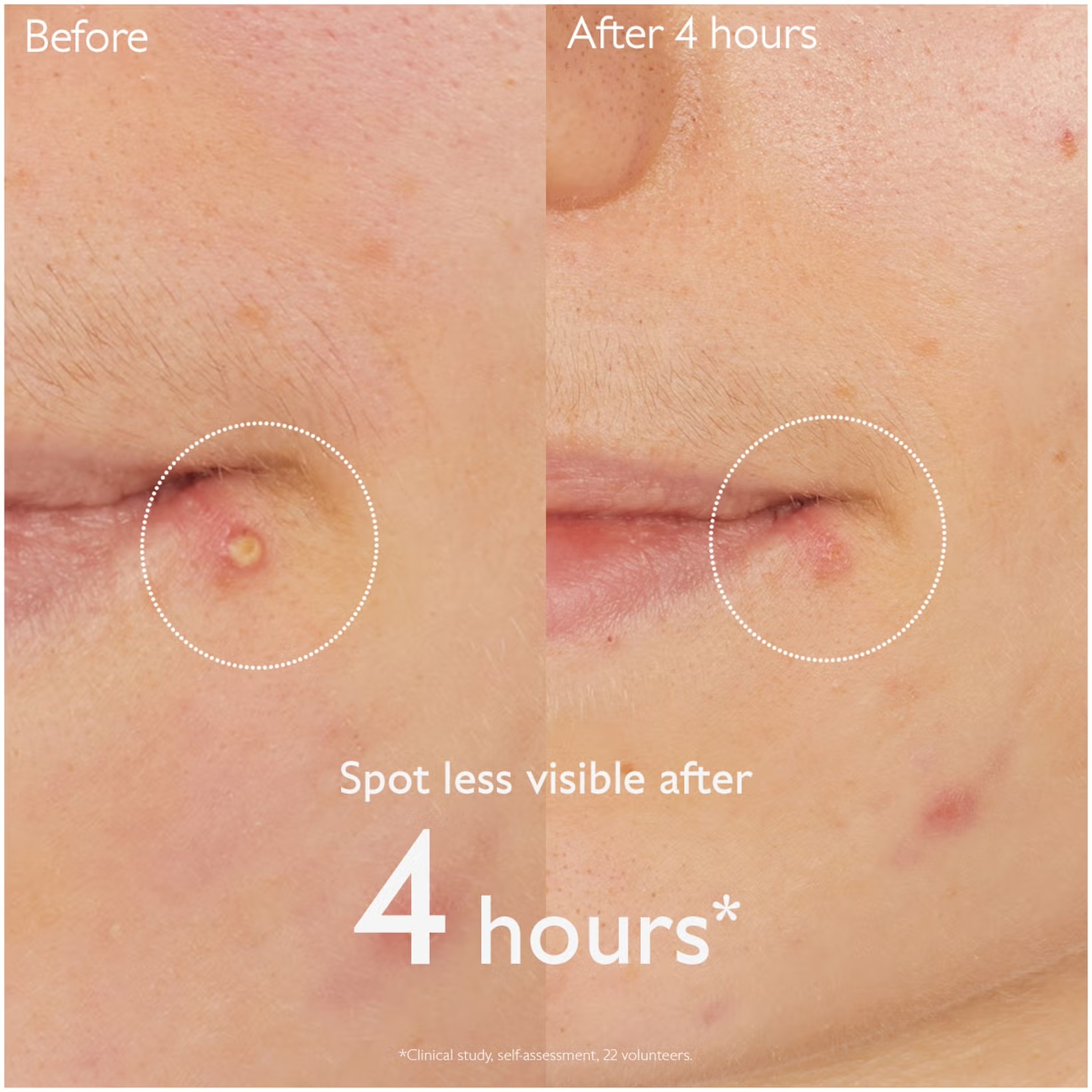 CAUDALIE Vinopure Salicylic Spot Solution купить в Beauty Storage. Быстрая доставка по России и СНГ.