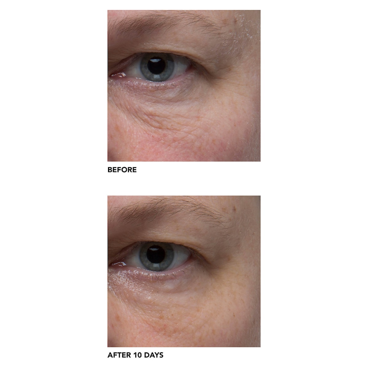 ALGENIST GENIUS Liquid Collagen купить в Beauty Storage. Быстрая доставка по России и СНГ.