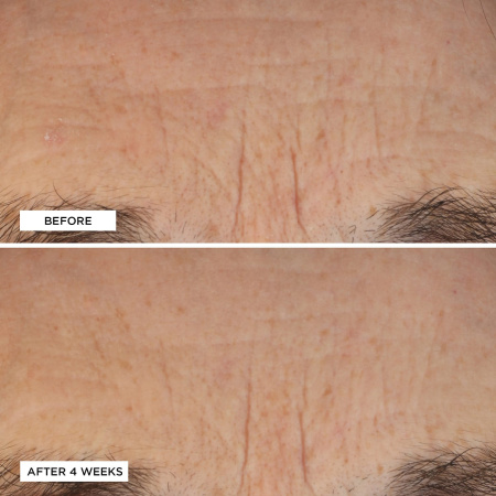 PERRICONE MD Essential Fx Acyl-Glutathione Deep Crease Serum