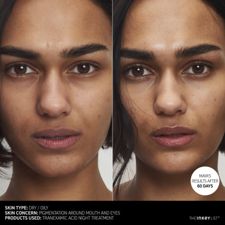 THE INKEY LIST Tranexamic Acid Overnight Treatment