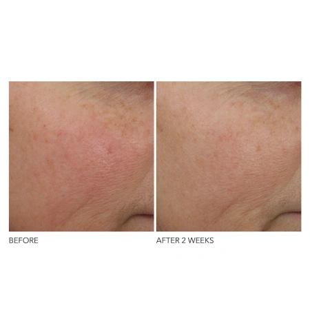 DR. DENNIS GROSS SKINCARE ADVANCED Retinol + Ferulic Overnight Wrinkle Treatment купить в Beauty Storage. Быстрая доставка по России и СНГ.
