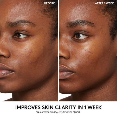 FENTY SKIN by Rihanna  Cherry Dub BHA Toner with Salicylic Acid + Aloe Juice купить в Beauty Storage. Быстрая доставка по России и СНГ.
