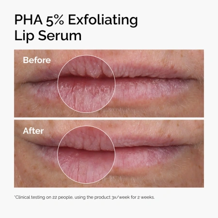 Купить THE ORDINARY PHA 5% Exfoliating Lip Serum на Beautystorage.ru. Быстрая доставка по России и СНГ.