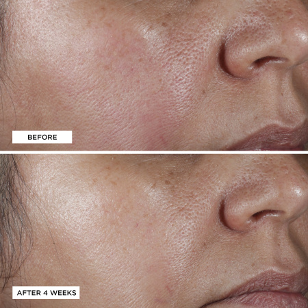 PERRICONE MD No:Rinse Intensive Pore Minimizing Toner