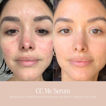 SUMMER FRIDAYS CC Me Vitamin C Serum