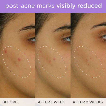 Купить TATCHA The Brightening Serum на Beautystorage.ru. Быстрая доставка по России и СНГ.