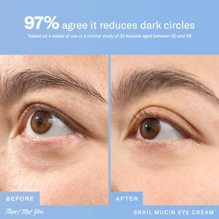 Купить THEN I MET YOU Snail Mucin Eye Cream на Beautystorage.ru. Быстрая доставка по России и СНГ.