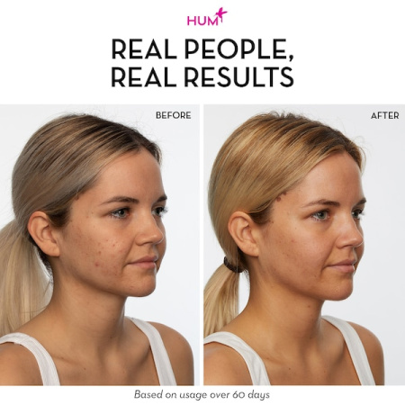 HUM NUTRITION Skin Squad™ Pre + Probiotic Clear Skin Supplement купить в Beauty Storage. Быстрая доставка по России и СНГ.