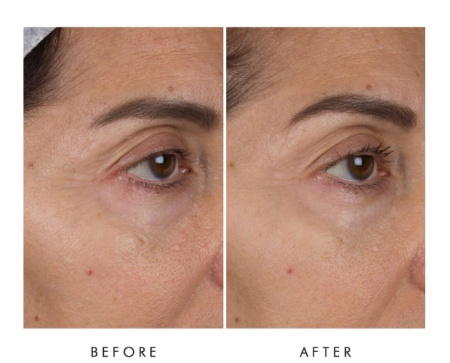 ALPHA-H Liquid Gold Firming Eye Cream