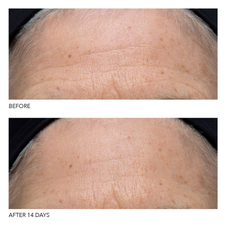 DR. DENNIS GROSS SKINCARE Vitamin C+ Collagen Deep Cream