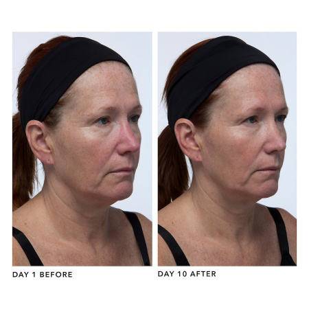 ALGENIST GENIUS Collagen Calming Relief купить в Beauty Storage. Быстрая доставка по России и СНГ.