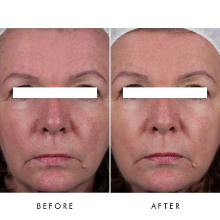 ALPHA-H Essential Hydration Cream