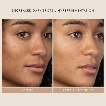 SHANI DARDEN SKIN CARE Lactic Acid AHA Exfoliating Serum купить в Beauty Storage. Быстрая доставка по России и СНГ.