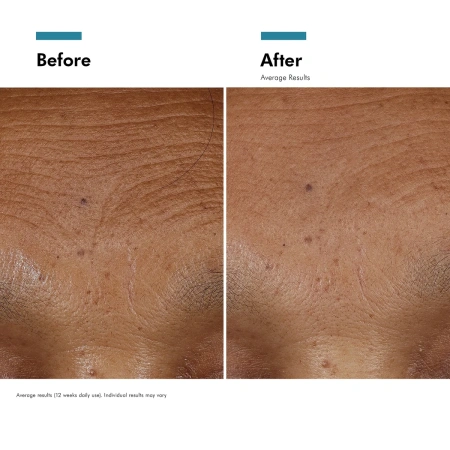 Купить SKINCEUTICALS Hyaluronic Acid Intensifier Multi-Glycan на Beautystorage.ru. Быстрая доставка по России и СНГ.