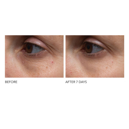 DR. DENNIS GROSS SKINCARE Vitamin C+ Collagen Brighten & Firm Eye Cream