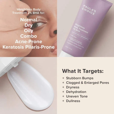PAULA'S CHOICE Weightless Body Treatment 2% BHA купить в Beauty Storage. Быстрая доставка по России и СНГ.
