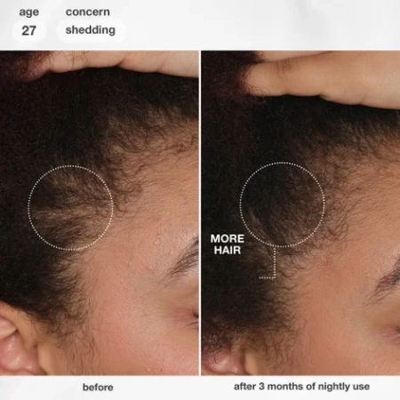 Купить K18 BIOMIMETIC HAIRSCIENCE FutureIQ Biomimetic Hair Longevity Serum на Beautystorage.ru. Быстрая доставка по России и СНГ.
