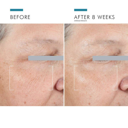 Купить SKINCEUTICALS  A.G.E. Advanced Eye for Dark Circles на Beautystorage.ru. Быстрая доставка по России и СНГ.