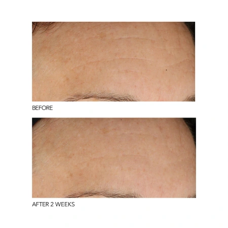 DR. DENNIS GROSS B₃Adaptive SuperFoods™ Stress Repair Face Cream купить в Beauty Storage. Быстрая доставка по России и СНГ.