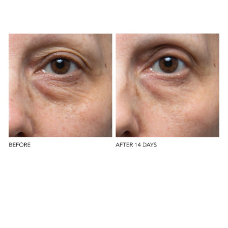 DR. DENNIS GROSS SKINCARE Ferulic + Retinol Eye Cream