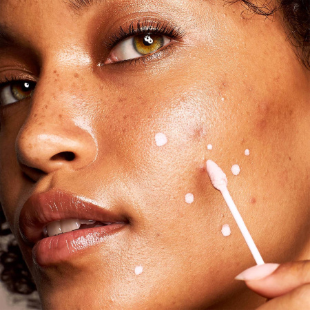 KATE SOMERVILLE EradiKate® 10% Sulfur Blemish Treatment купить в Beauty Storage. Быстрая доставка по России и СНГ.