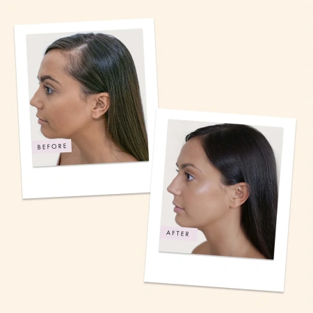 Купить HAIR GAIN Gummies - 60 Gummies на Beautystorage.ru. Быстрая доставка по России и СНГ.