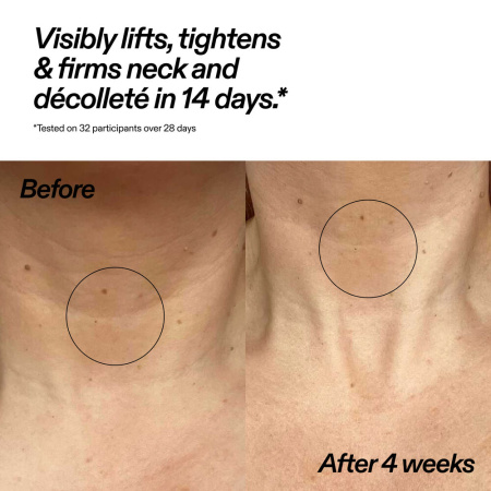 Купить The INKEY List Bio-active Ceramide Neck Stick на Beautystorage.ru. Быстрая доставка по России и СНГ.