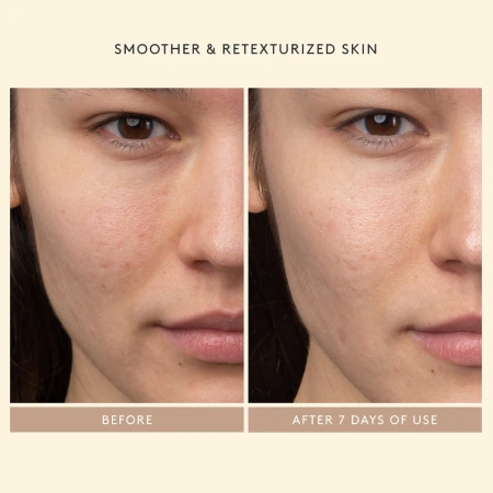 SHANI DARDEN SKIN CARE Lactic Acid AHA Exfoliating Serum купить в Beauty Storage. Быстрая доставка по России и СНГ.