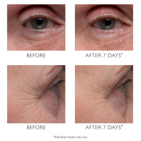 PETER THOMAS ROTH Potent-C™ Vitamin C Power Eye Cream