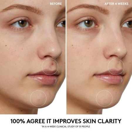 FENTY BEAUTY by Rihanna  Cherry Dub Pore Purify’r Gel Cleanser купить в Beauty Storage. Быстрая доставка по России и СНГ.