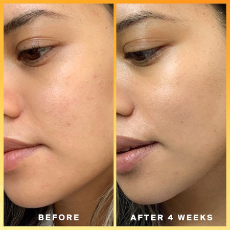 SUPERGOOP! Daily Dose Vitamin C + SPF 40 Sunscreen Serum PA+++ купить в Beauty Storage. Быстрая доставка по России и СНГ.
