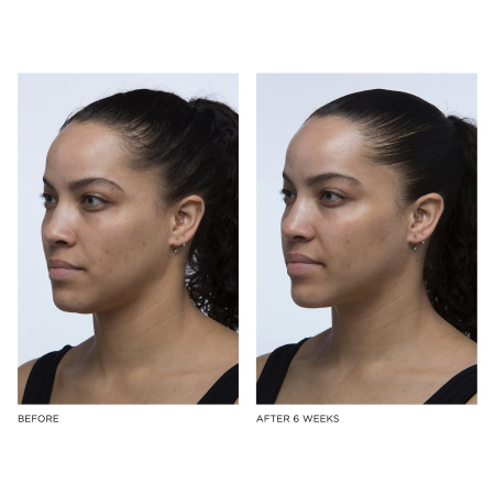 GLOW RECIPE Pineapple-C Brightening Serum