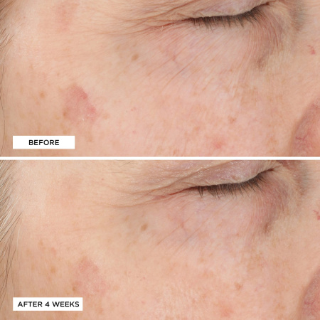 PERRICONE MD Essential Fx Acyl-Glutathione Rejuvenating Moisturizer