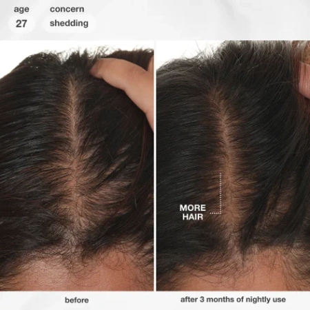 Купить K18 BIOMIMETIC HAIRSCIENCE FutureIQ Biomimetic Hair Longevity Serum на Beautystorage.ru. Быстрая доставка по России и СНГ.