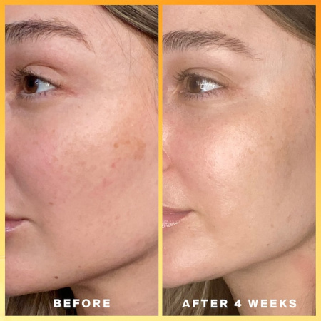 SUPERGOOP! Daily Dose Vitamin C + SPF 40 Sunscreen Serum PA+++ купить в Beauty Storage. Быстрая доставка по России и СНГ.